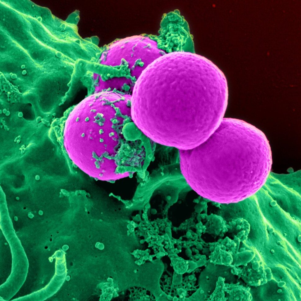bacteria type